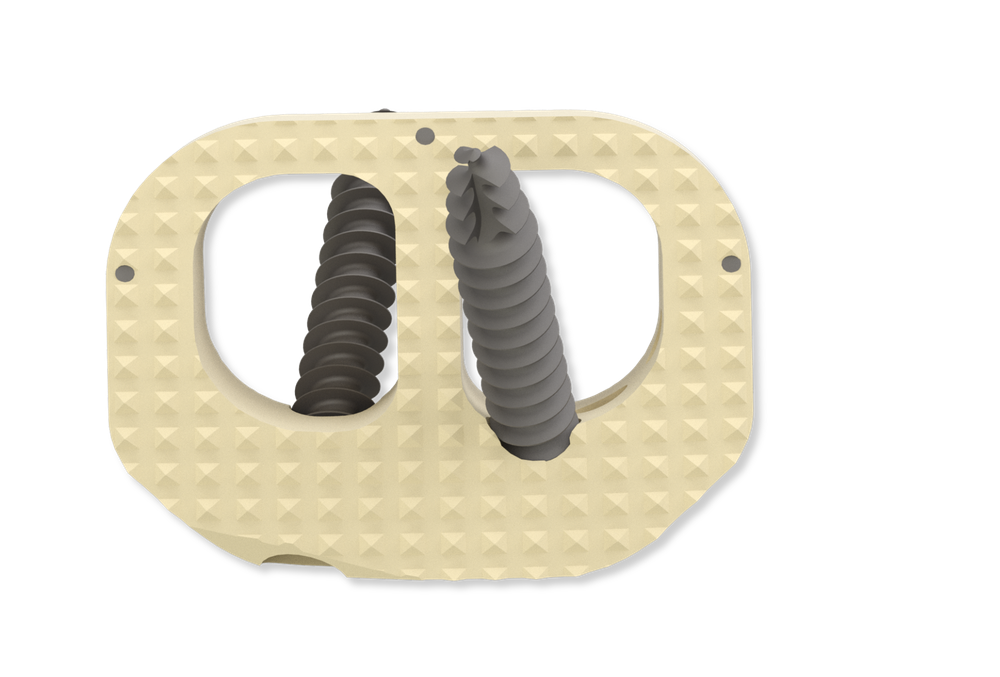 ALIF OsteoFusion